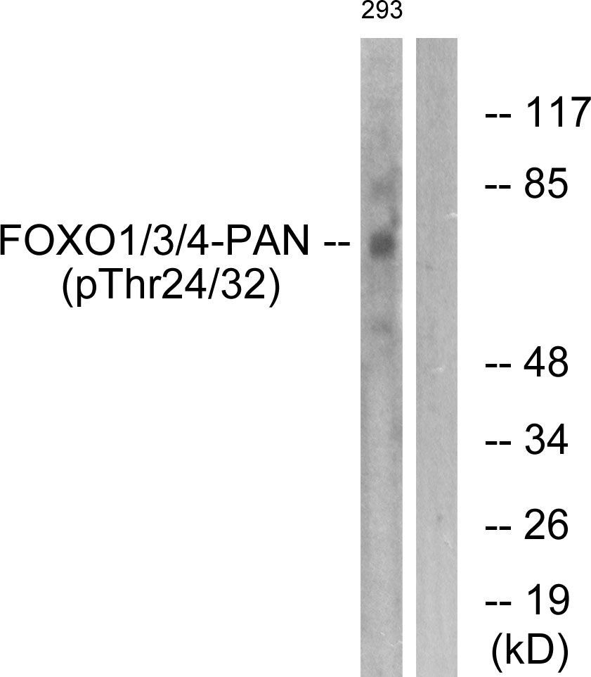 FOXO1/3/4-pan (Phospho-Thr24/32) Rabbit Polyclonal Antibody, 100 ug