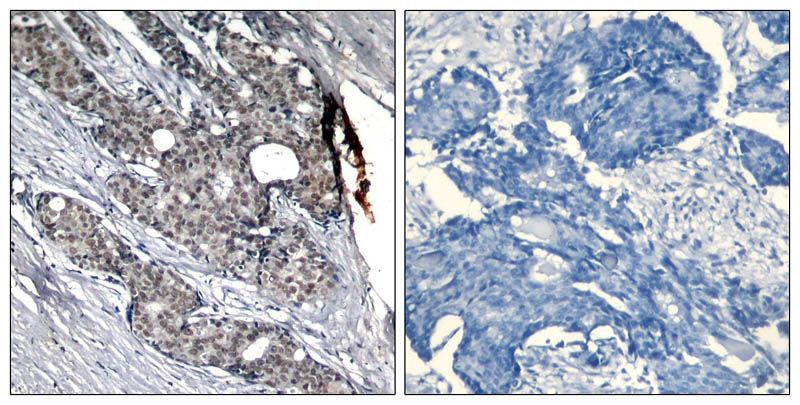 p53 (Phospho-Ser6) Rabbit Polyclonal Antibody, 100 ug
