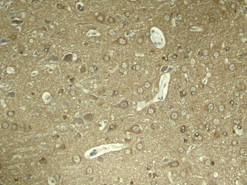 Tau (Phospho-Ser404) Rabbit Polyclonal Antibody, 100 ug