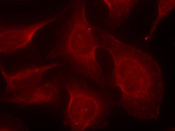 BIM (Phospho-Ser69) Rabbit Polyclonal Antibody, 100 ug