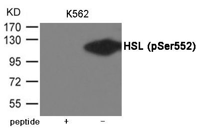 HSL (Phospho-Ser552) Rabbit Polyclonal Antibody, 100 ug