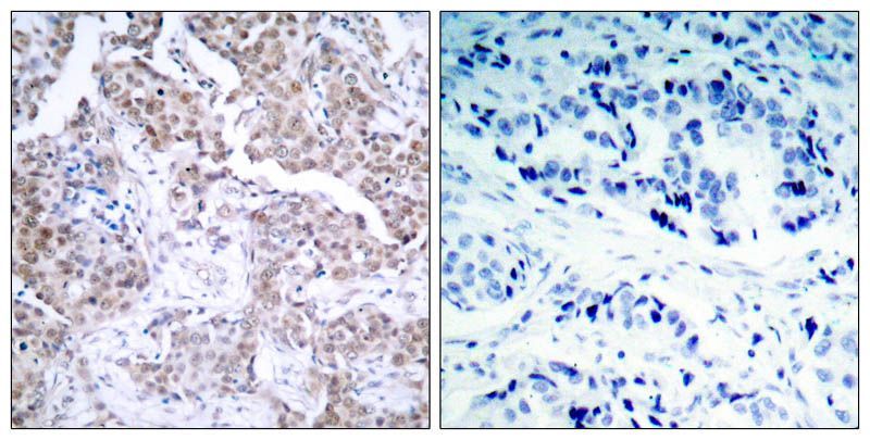 p53 (Phospho-Ser15) Rabbit Polyclonal Antibody, 100 ug