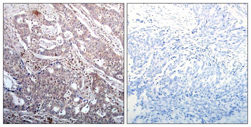 IκB-β (Phospho-Ser23) Rabbit Polyclonal Antibody, 100 ug