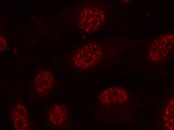 MAPKAPK-2 (Phospho-Thr334) Rabbit Polyclonal Antibody, 100 ug