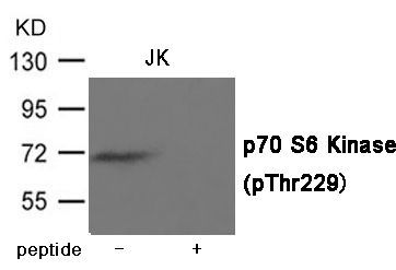 p70 S6 Kinase (Phospho-Thr229) Rabbit Polyclonal Antibody, 100 ug