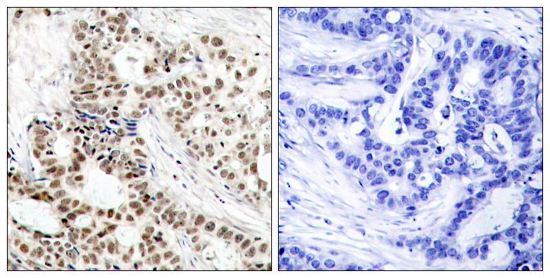 BRCA1 (Phospho-Ser1423) Rabbit Polyclonal Antibody, 100 ug