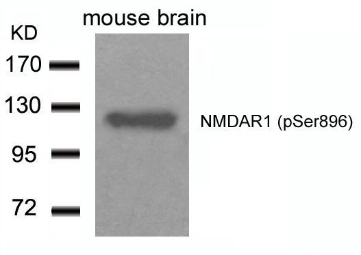 NMDAR1 (Phospho-Ser896) Rabbit Polyclonal Antibody, 100 ug