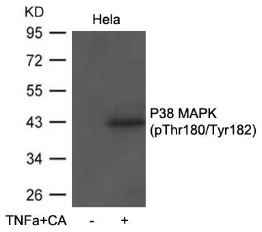 P38 MAPK(Phospho-Thr180/Tyr182) Rabbit Polyclonal Antibody, 100 ug