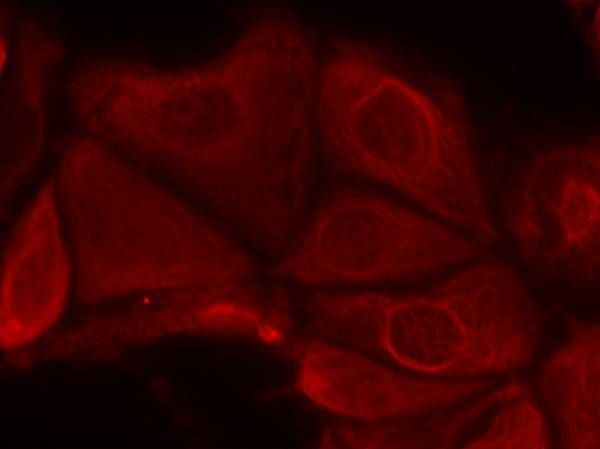 p70 S6 Kinase (Phospho-Ser411) Rabbit Polyclonal Antibody, 100 ug