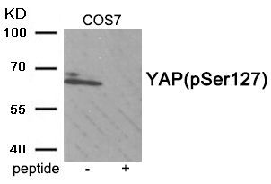 YAP (Phospho-Ser127) Rabbit Polyclonal Antibody, 100 ug