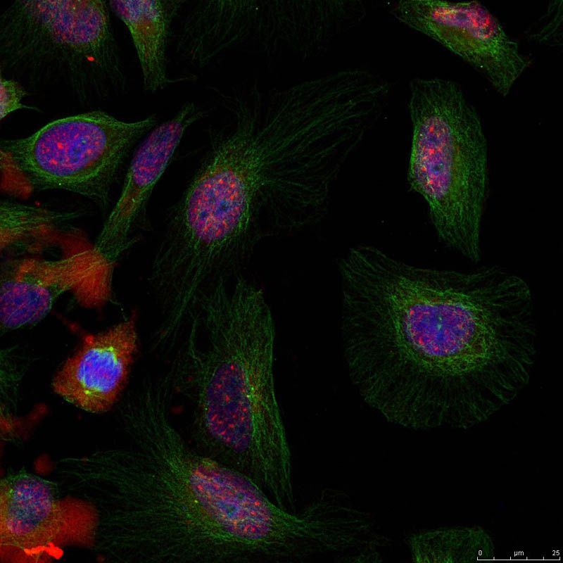 FAK (phospho-Tyr576/Tyr577) Rabbit Polyclonal Antibody, 100 ug