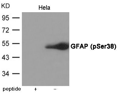 GFAP (Phospho-Ser38) Rabbit Polyclonal Antibody, 100 ug