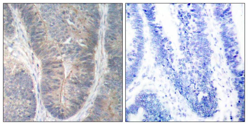 PKR (Phospho-Thr451) Rabbit Polyclonal Antibody, 100 ug