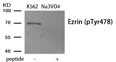 Ezrin (Phospho-Tyr478) Rabbit Polyclonal Antibody, 100 ug