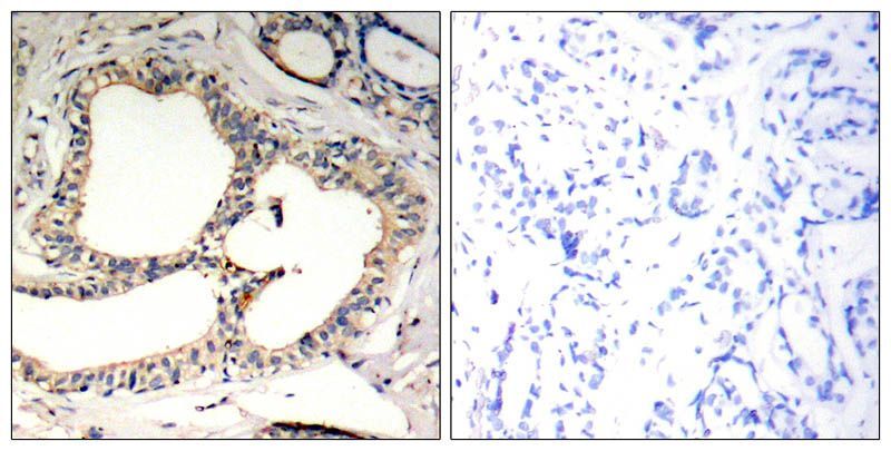 Tyrosine Hydroxylase (Phospho-Ser40) Rabbit Polyclonal Antibody, 100 ug