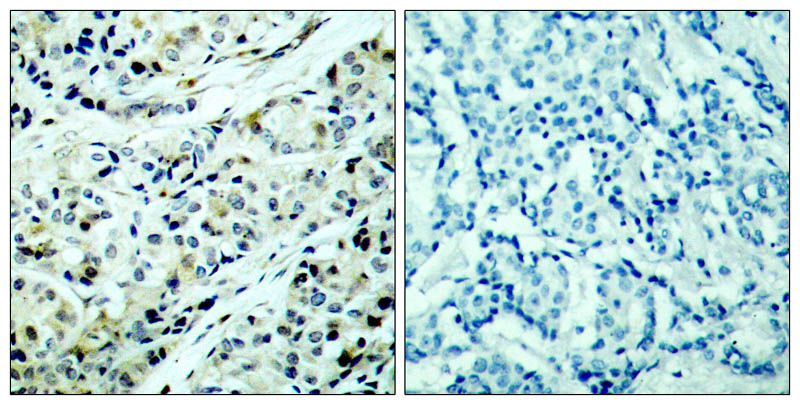 HDAC5 (Phospho-Ser498) Rabbit Polyclonal Antibody, 100 ug