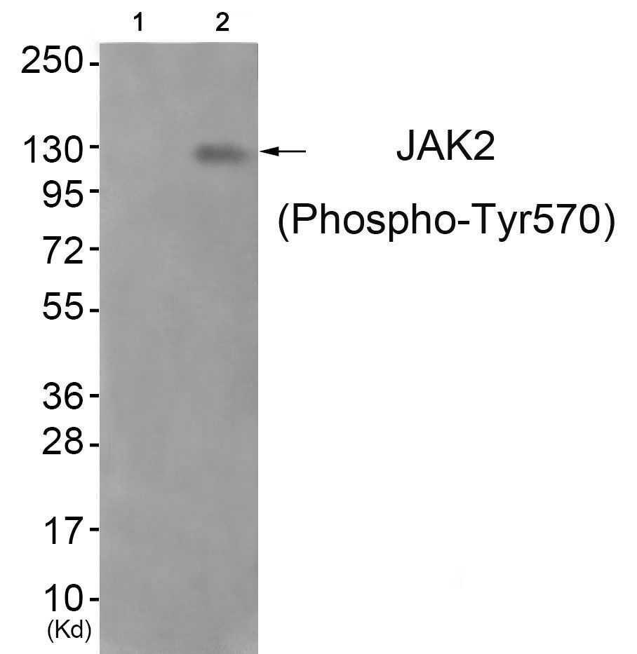 JAK2 (Phospho-Tyr570) Rabbit Polyclonal Antibody, 100 ug