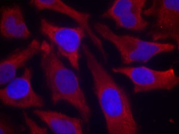 synapsin (Phospho-Ser9) Rabbit Polyclonal Antibody, 100 ug