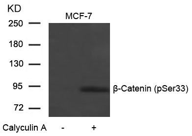 β-Catenin (Phospho-Ser33) Rabbit Polyclonal Antibody, 100 ug