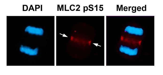 MLC2 (Phospho-Ser15) Rabbit Polyclonal Antibody, 100 ug