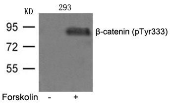 β-catenin (phospho-Tyr333) Rabbit Polyclonal Antibody, 100 ug