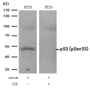 p53 (Phospho-Ser33) Rabbit Polyclonal Antibody, 100 ug