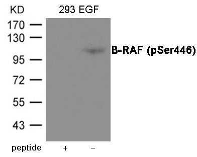 B-RAF (Phospho-Ser446) Rabbit Polyclonal Antibody, 100 ug