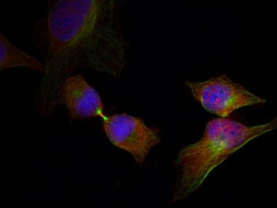 HSP27 (Phospho-Ser78) Rabbit Polyclonal Antibody, 100 ug HSP27 (Phospho-Ser78) Rabbit Polyclonal Antibody, 100 ug