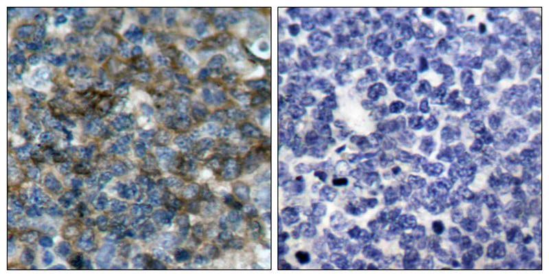 IkB-ε (Phospho-Ser22) Rabbit Polyclonal Antibody, 100 ug