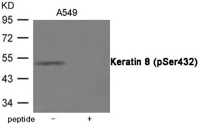 Keratin 8 (Phospho-Ser432) Rabbit Polyclonal Antibody, 100 ug