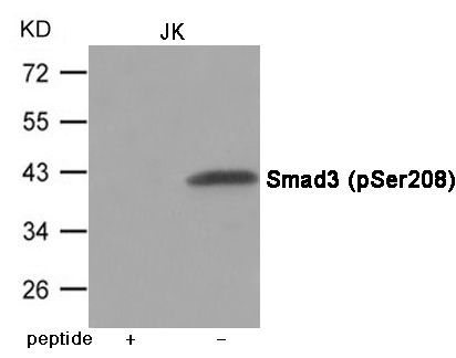 Smad3 (Phospho-Ser208) Rabbit Polyclonal Antibody, 100 ug