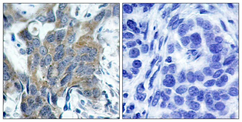 NFκB-p65 (Phospho-Ser529) Rabbit Polyclonal Antibody, 100 ug