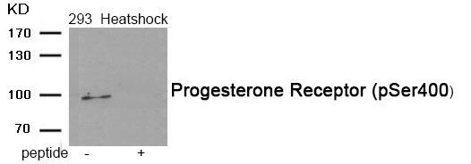 Progesterone Receptor (Phospho-Ser400) Rabbit Polyclonal Antibody, 100 ug