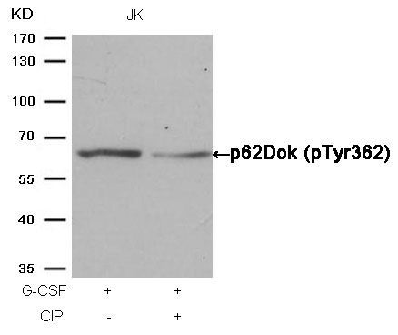 p62Dok (phospho-Tyr362) Rabbit Polyclonal Antibody, 100 ug