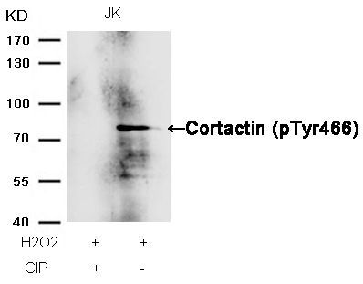 Cortactin (Phospho-Tyr466) Rabbit Polyclonal Antibody, 100 ug