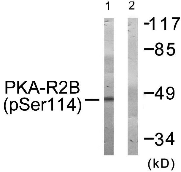 PKA-R2β (Phospho-Ser114) Rabbit Polyclonal Antibody, 100 ug