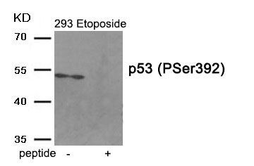 p53 (Phospho-Ser392) Rabbit Polyclonal Antibody, 100 ug