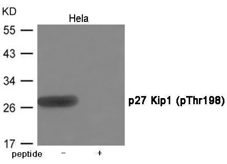 p27 Kip1 (Phospho-Thr198) Rabbit Polyclonal Antibody, 100 ug