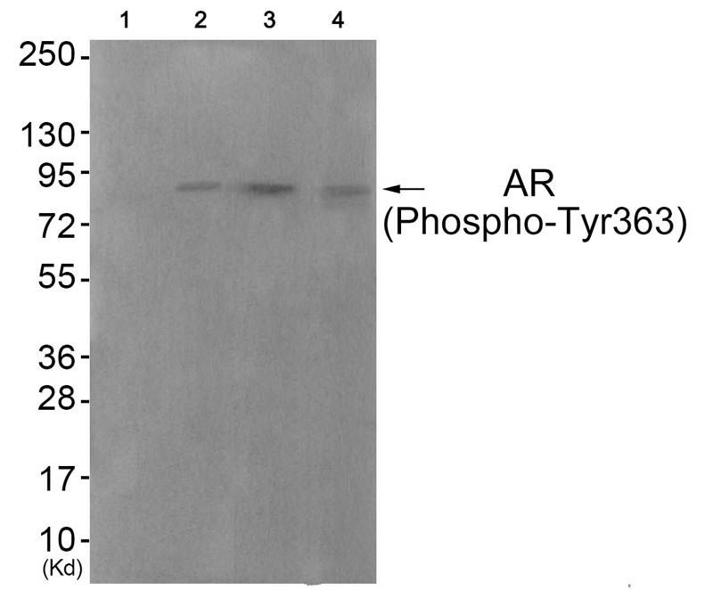 Androgen Receptor (Phospho-Tyr363) Rabbit Polyclonal Antibody, 100 ug