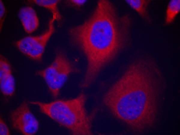 ADD1 (Phospho-Ser726) Rabbit Polyclonal Antibody, 100 ug