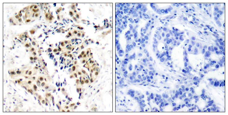 ATM (Phospho-Ser1981) Rabbit Polyclonal Antibody, 100 ug