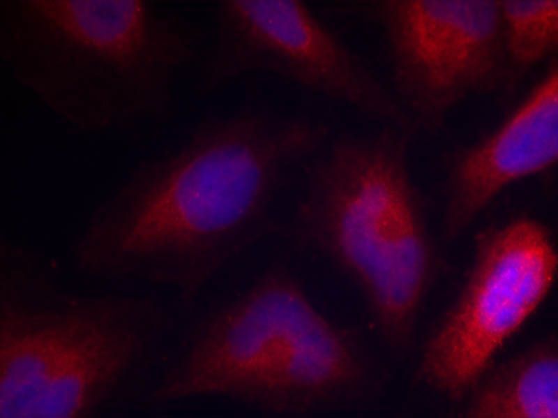 MARCKS (Phospho-Ser162) Rabbit Polyclonal Antibody, 100 ug