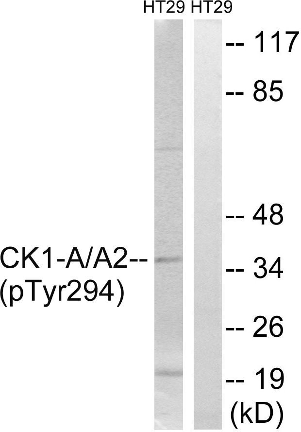 CK-1α (Phospho-Tyr294) Rabbit Polyclonal Antibody, 100 ug