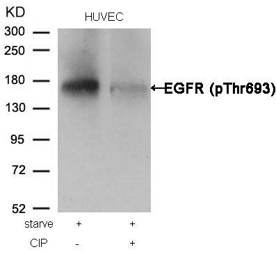 EGFR (Phospho-Thr693) Rabbit Polyclonal Antibody, 100 ug