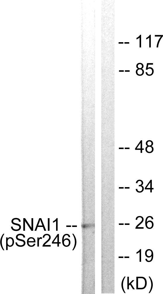 SNAI1 (Phospho-Ser246) Rabbit Polyclonal Antibody, 100 ug