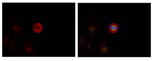 p44/42 MAP Kinase (Phospho-Tyr204) Rabbit Polyclonal Antibody, 100 ug