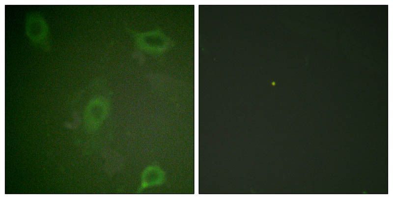 Amyloid β A4 (Phospho-Thr743/668) Rabbit Polyclonal Antibody, 100 ug