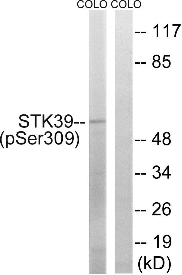 STK39 (Phospho-Ser309) Rabbit Polyclonal Antibody, 100 ug