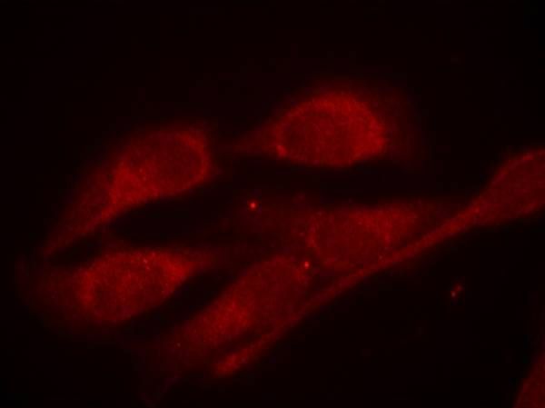 Shc1 (Phospho-Tyr427) Rabbit Polyclonal Antibody, 100 ug