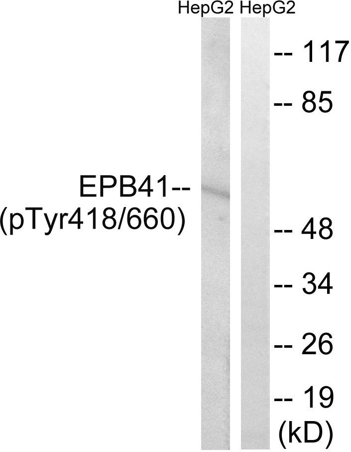 EPB41 (Phospho-Tyr660/418) Rabbit Polyclonal Antibody, 100 ug